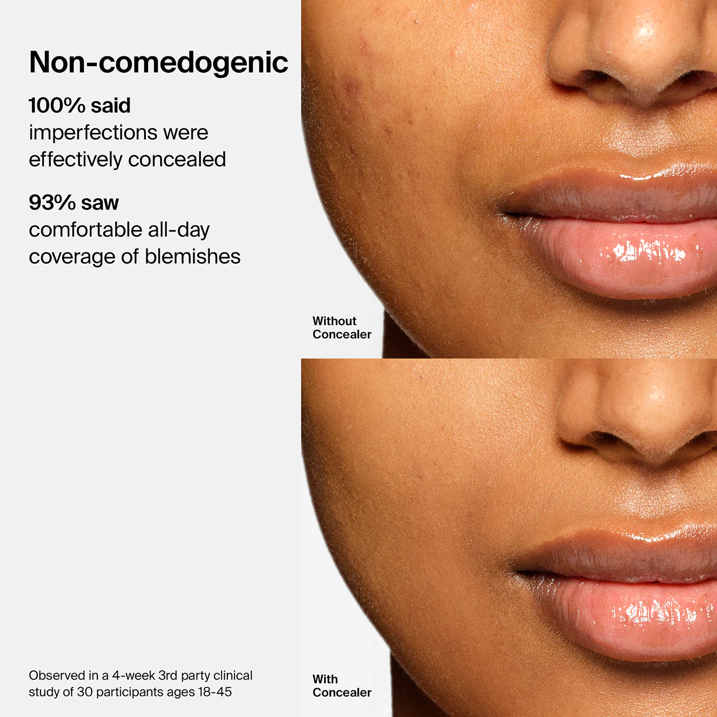 Triclone™ Skin Tech Concealer - Image 107